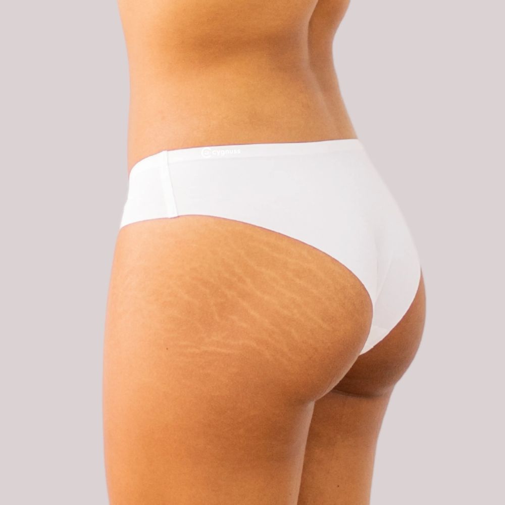 Vista lateral da região do quadril de uma mulher usando uma calcinha fio-dental branca sem costura da Cygnuss. A imagem destaca o ajuste confortável da peça ao corpo e a naturalidade das curvas.