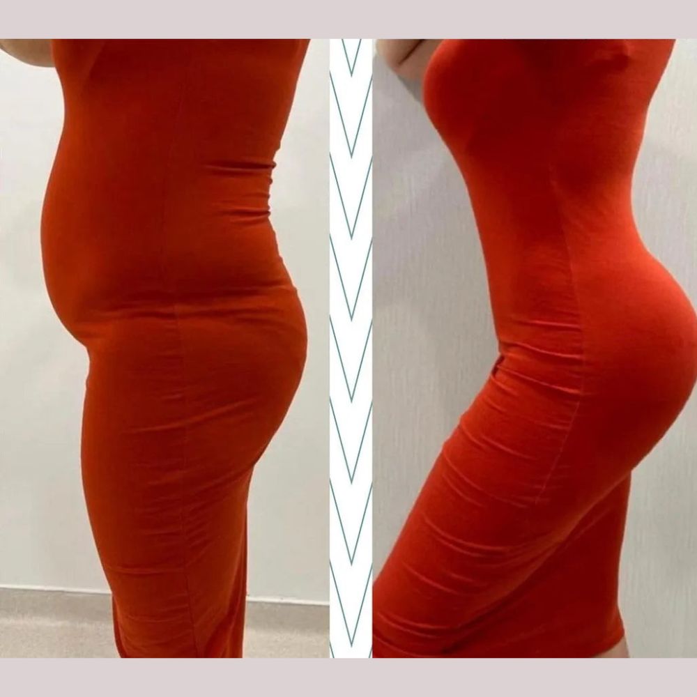 Imagem mostrando uma comparação de antes e depois de usar um modelador. A foto à esquerda mostra a modelo com um vestido vermelho ajustado, destacando a área do abdômen. A foto à direita mostra a mesma modelo com a mesma roupa, mas após usar o modelador, exibindo uma silhueta mais contornada e uma barriga mais lisa.